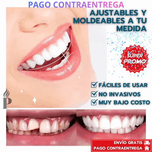 CARILLAS DENTALES CAMBIA TU SONRISA EN MINUTOS.