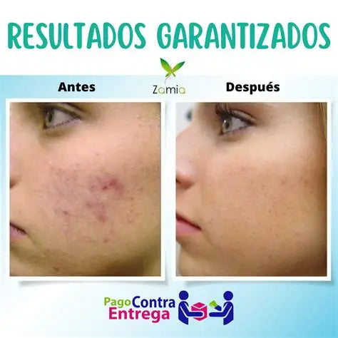 BB CREAM ANTIACNÉ ORIGINAL   1809040